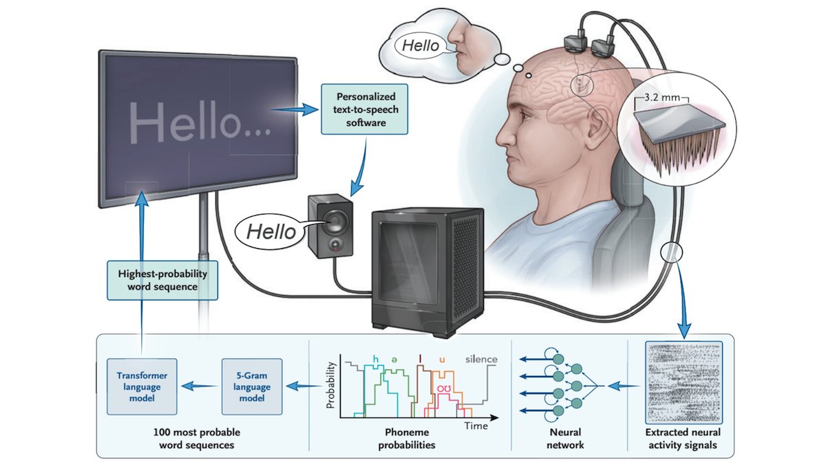 A man with electrodes connected through his skull is connected to a machine, which is connected to a screen that says 